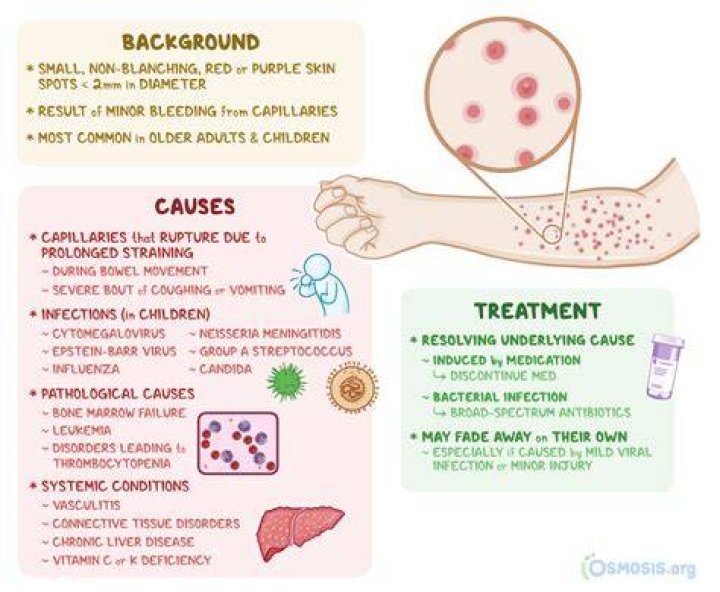 Does petechiae go away?