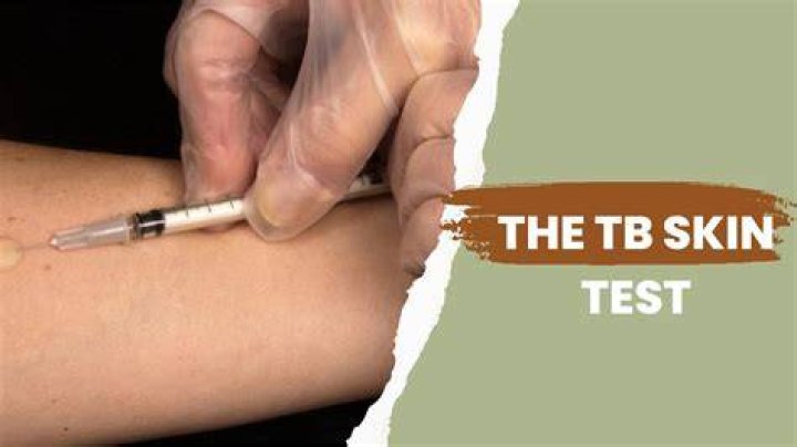 Where does concentra send urine tests?